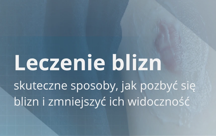 Leczenie_blizn_d24