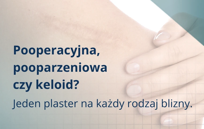 Pooperacyjna__pooparzeniowa_czy_keloid_d24