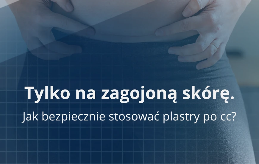 Tylko_na_zagojona_skore_d24