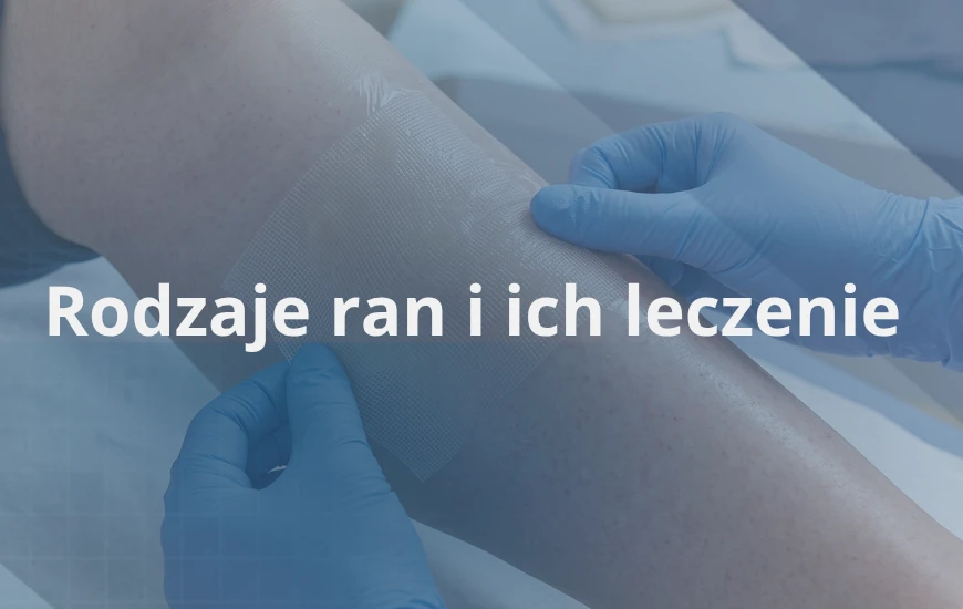 Rodzaje_ran_i_ich_leczenie_d24