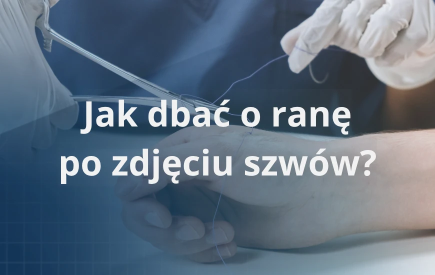 Jak_dbac_o_rane_po_zdjeciu_szwow_d24
