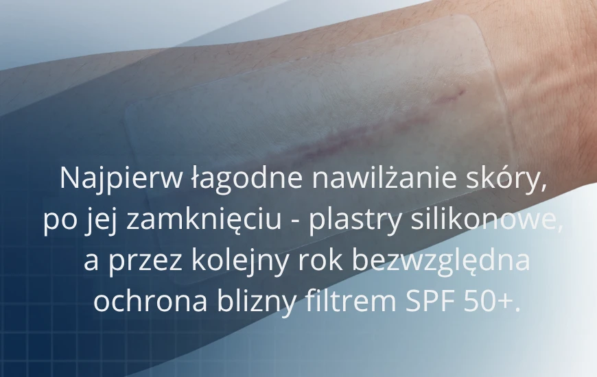 Najpierw_lagodne_nawilzanie_skory_d24