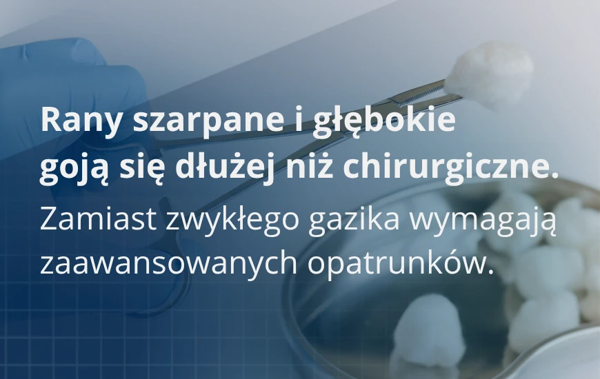 Rany_szarpane_i_glebokie__goja_sie_dluzej_niz_chirurgiczne_d24