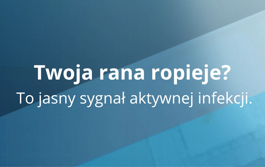Twoja_rana_ropieje_d24