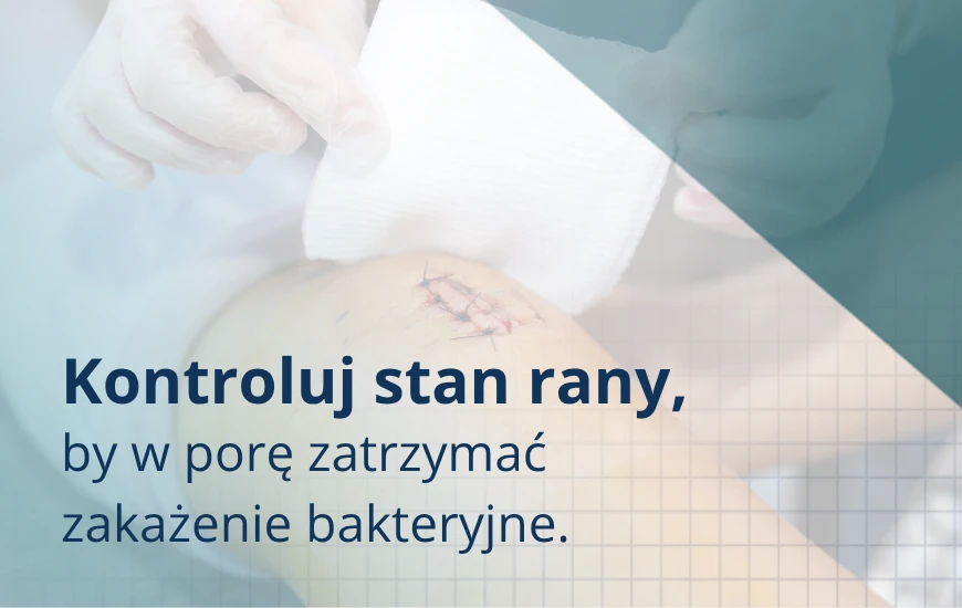 Kontroluj_stan_rany_d24