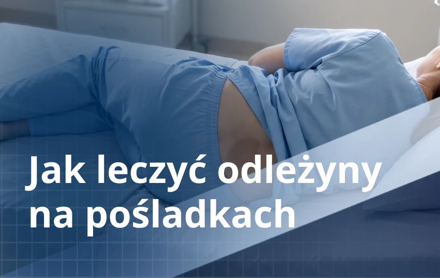 Jak_leczyc_odlezyny_na_posladkach_d24