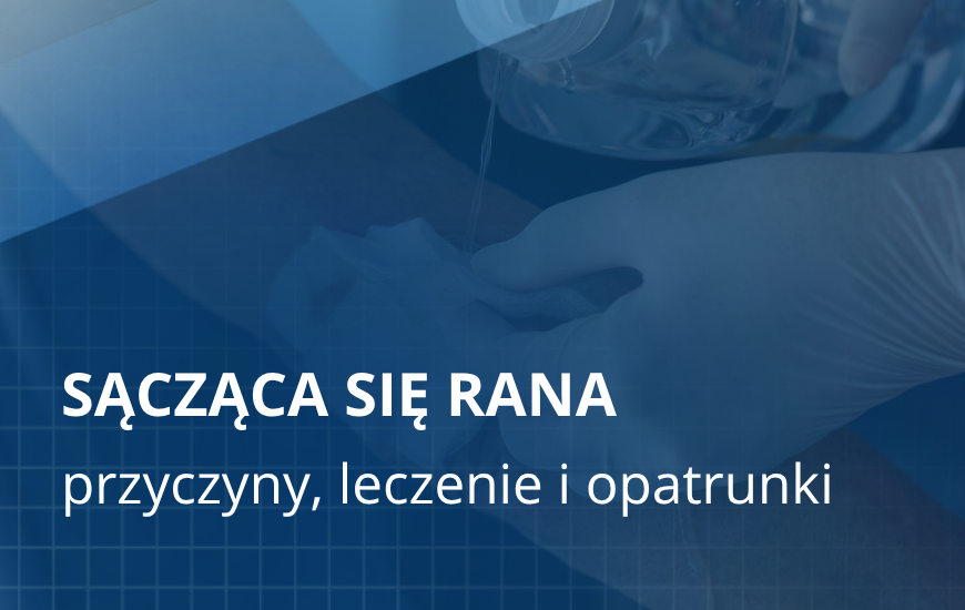 Sącząca się rana: przyczyny, leczenie i opatrunki