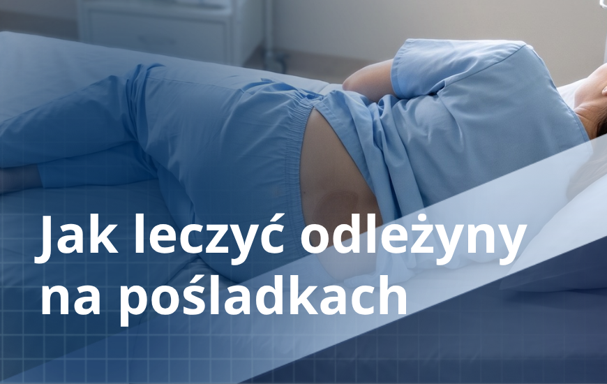 Jak leczyć odleżyny na pośladkach