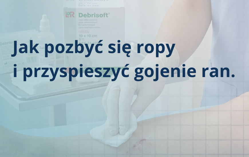 Jak pozbyć się ropy i przyspieszyć gojenie ran