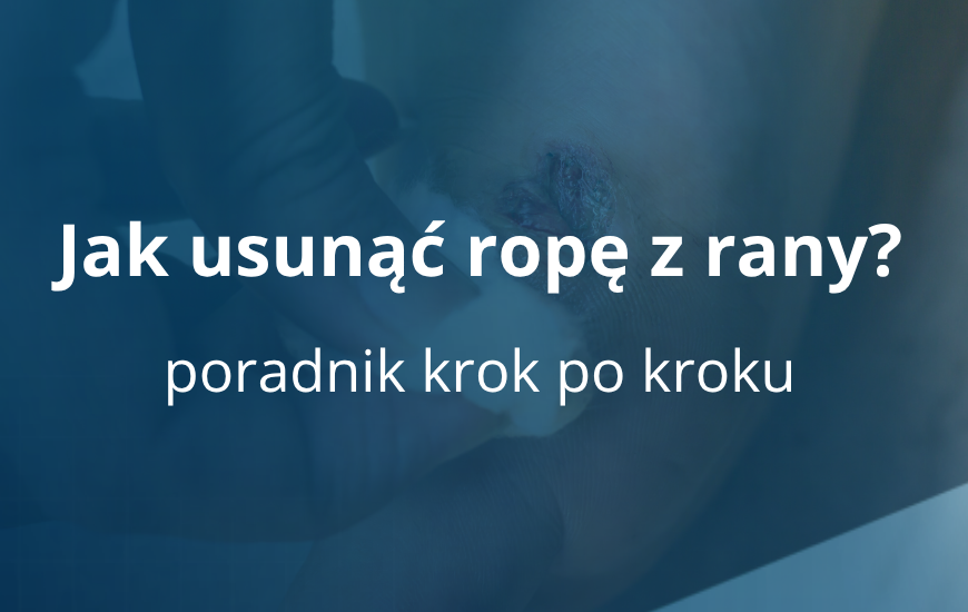 Jak usunąć ropę z rany? Poradnik krok po kroku