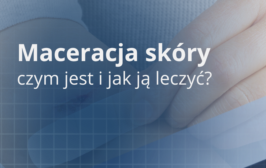 Maceracja skóry: czym jest i jak ją leczyć?