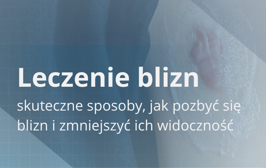 Leczenie blizn – skuteczne sposoby, jak pozbyć się blizn i zmniejszyć ich widoczność