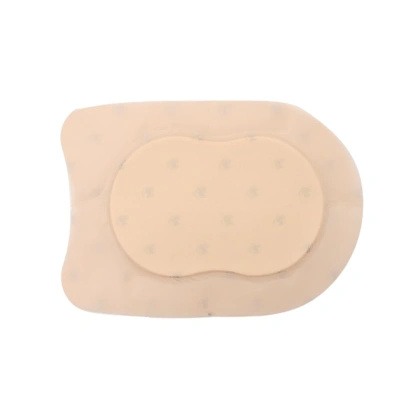 Aquacel Ag foam Adhesive Heel - opatrunek przylepny 19,8  x 14 cm (5 szt.) - ConvaTec